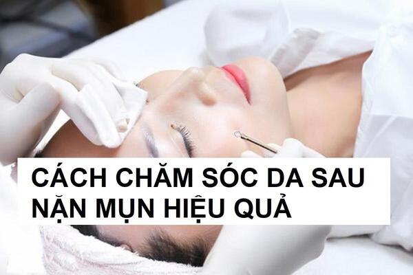 chăm sóc da sau nặn mụn